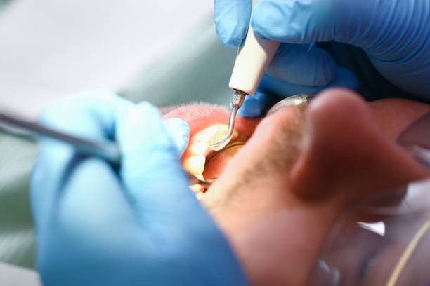 Best Pediatric Emergency Dentist in Marina, CA